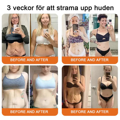 Tillverkad och skickad från Sverige 💥Pureluxo® Bee Venom Skin Repair Cream ⏰ Sista dagen 80% rabatt