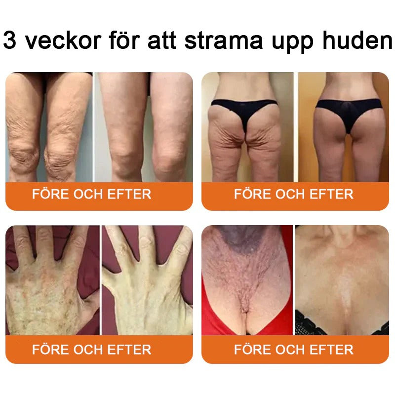 Tillverkad och skickad från Sverige 💥Pureluxo® Bee Venom Skin Repair Cream ⏰ Sista dagen 80% rabatt