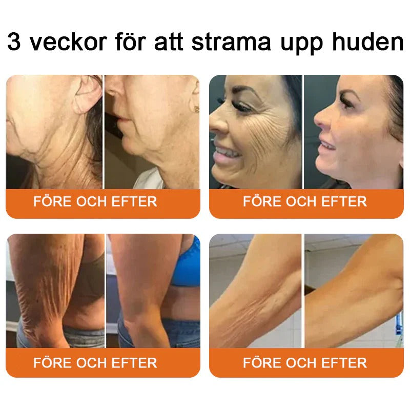 Tillverkad och skickad från Sverige 💥Pureluxo® Bee Venom Skin Repair Cream ⏰ Sista dagen 80% rabatt